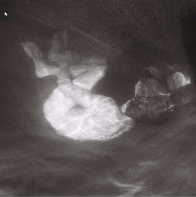 Alice Phoebe Lou : Glow (LP, Album)